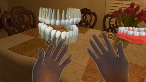 Mixed reality dental prototype showing a model of teeth